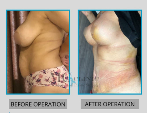 Slider image (3) MEHMET CEBER CLINIC